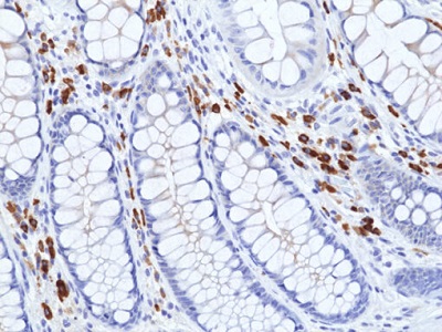 Immunohistochemical staining of formalin-fixed and paraffin-embedded human colon tissue section using anti-Human IgA (alpha1 & alpha2) Rabbit Monoclonal Antibody (Clone RM513) at 1:200 dilution.