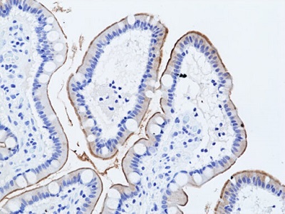 Immunohistochemical staining of formalin-fixed and paraffin-embedded human small intestine tissue sections using anti-Muc17 Rabbit Monoclonal Antibody (Clone RM517) at 1:100 dilution for 1 hr at room temperature.