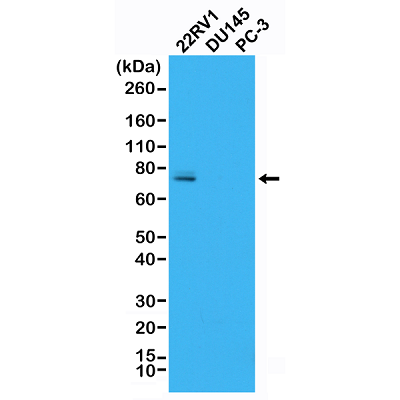 Western Blot analysis of 22RV1, DU145 and PC-3 whole cell lysates, using anti-AR-V7 rabbit monoclonal Antibody (Clone RM7), showed endogenous AR-V7 expressed in 22RV1 cells.