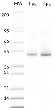 Parkin (E3 Ligase) (human) (rec.) (His)