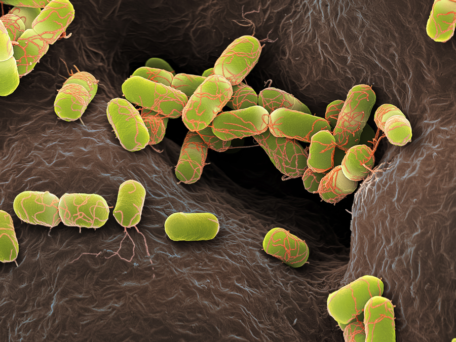 E. coli are gram-negative rod-shaped bacteria.