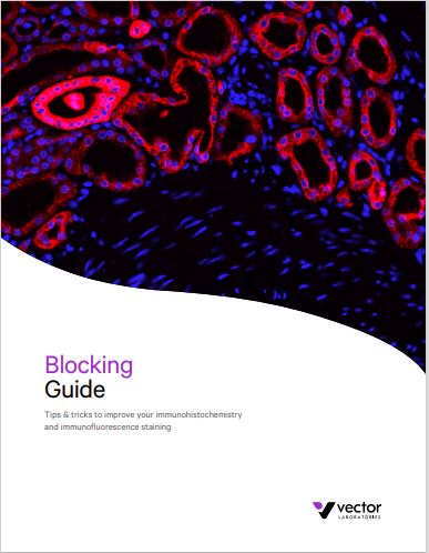Blocking Guide