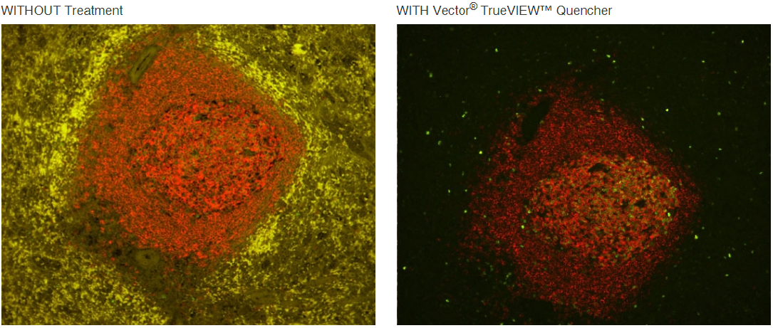 TrueVIEW™ Autofluorescence Quenching Kit